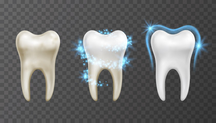 vector illustration of teeth whitening process - cleaning and protection from stains and bacteria