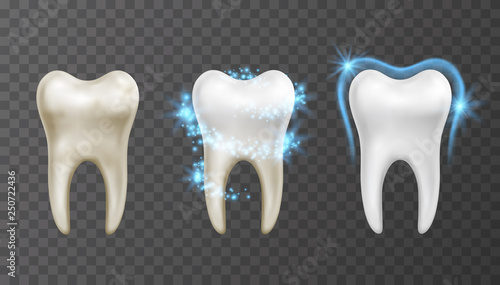 Cuadros en Lienzo Vector illustration of teeth whitening process - cleaning and protection from st