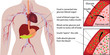 Blood sugar glucose absorbtion in a human body  infographics