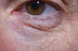© Curto - detail of eye bags and wrinkles of a middle-aged woman
