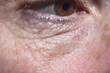 © Curto - detail of eye bags and wrinkles of a middle-aged woman