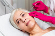 Mature woman is getting a rejuvenating facial injections. She is lying calmly at clinic. The expert beautician is injecting botox into woman's wrinkles.