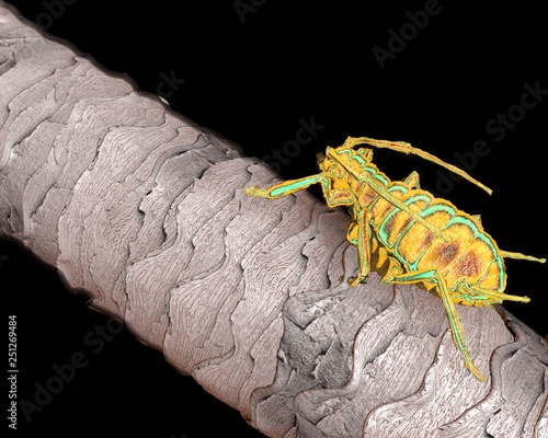 Lice On Hair Close Up As A Medical Problem Concept As Follicles