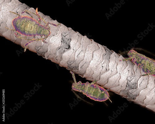 Lice On Hair Close Up As A Medical Problem Concept As Follicles