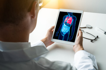 Wall Mural - Doctor working with x-ray of lungs on a laptop. Cancer prevention concept