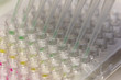 pipetting some different substances with different colors close up