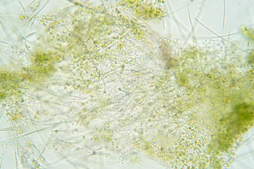 Wall Mural - Filamentous algae are single algae cells that form long visible chains.