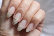 © Liliia - Damage of the nail after using shellac.