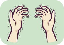 Hands Symptom Tremors Illustration