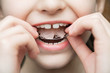 A girl wears a removable orthodontic appliance. Concept of pediatric dentistry, correcting the bite. Closeup, selective focus