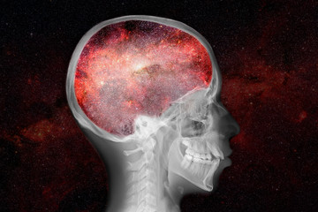 Wall Mural - x-ray of skull with universe inside