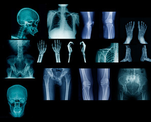 Canvas Print - big collection x-ray image on black or dark background