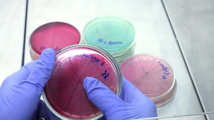 Poster - Analysis of colored bacteria. The scientist goes through the petri dishes and analyzes the bacteria. Petri dishes are divided into sectors. 