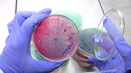 Poster - Bacteria red on agar. A scientist opens a Petri dish and examines red bacteria. Analysis of bacteria in a Petri dish. 