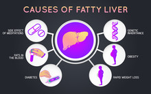 Causes Of Fatty Liver Logo Icon Design, Medical Vector Illustration