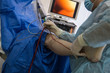 Knee keyhole surgery hospital arthroscopy operation medical procedure in hospital. Surgeons at work.