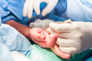 Surgeon suturing the hand of a patient at the end of surgery