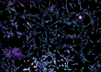 Real fluorescence microscopic view of human skin fibroblasts