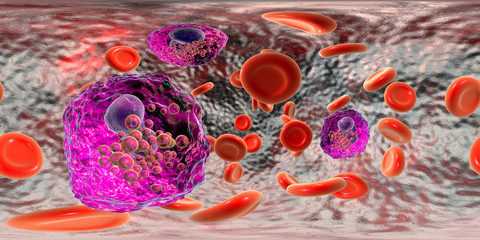 Canvas Print - 360-degree spherical panorama of blood with eosinophilia showing multiple eosinophils surrounded by red blood cells, 3D illustration