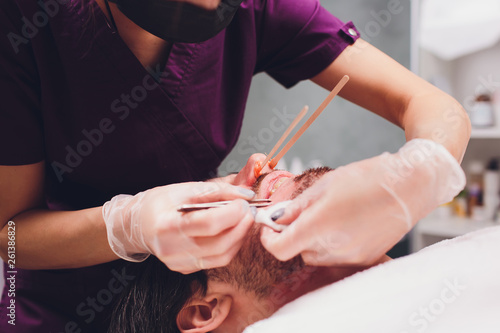 Hair Removal Man S Face Sugaring Epilationsy Ellow Color In