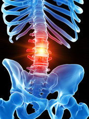 3d rendered medically accurate illustration of the lumbar spine showing pain