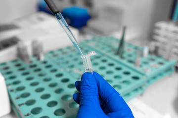 Closeup laboratory assistant analyzing a blood sample using micropipette. Science and medicine concept