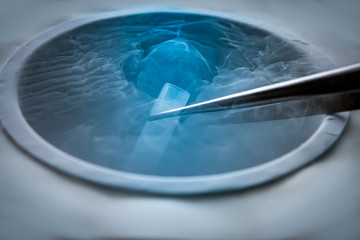 cryopreservation of test tube on liquid nitrogen, a liquid nitrogen bank containing sperm and eggs c