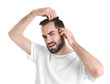 Young man with hair loss problem on white background