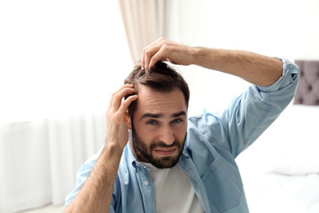 Young man with hair loss problem indoors