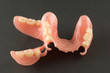 image of a modern denture