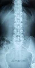 Naklejka na meble X-ray of pelvic bones and human spine.