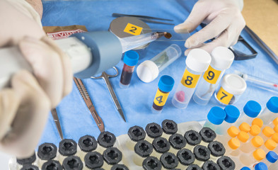 Police expert checks samples chemical as fundamental test in a murder case in crime lab