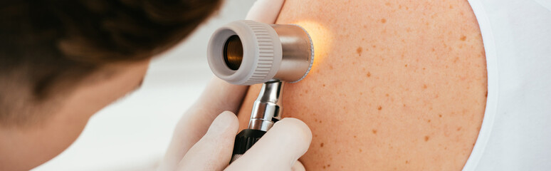 Wall Mural - panoramic shot of dermatologist in latex gloves holding dermatoscope while examining patient with skin disease