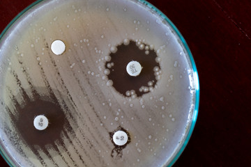 Drug testing of microbiology laboratory.