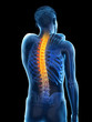 © Sebastian Kaulitzki - 3d rendered medically accurate illustration of a man having a backache