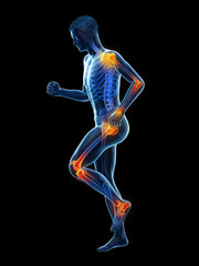 Poster - 3d rendered medically accurate illustration of a walking man with painful jonts