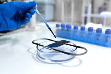 scientist prepare blood sample for research on microscope. Placing blood sample on microscope slide