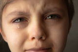 Fototapeta Koty - Tears in the eyes of a child. A tear on the boy's cheek.