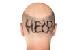 Concept of hair loss. Back view of balding male head isolated on white background. Detail showed alopecia