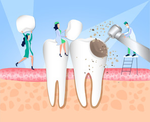 Doctors of the dental clinic carry out treatment of the tooth affected by caries. Violation of enamel, tooth infection, bacteria. Dentistry, treatment of toothache. Vector illustration