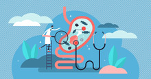 Gastroenterology Vector Illustration. Tiny Stomach Doctor Persons Concept.