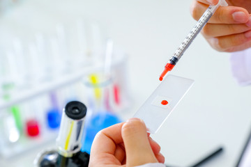 Medical equipment. Blood test.Pipette adding fluid to one of several test tubes