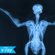 This x-ray. Bird skeleton The skeleton of a crow. Professional x-ray.