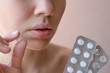© domaskina - Part of a young woman's face with a virus herpes simplex on lips, treatment with pills