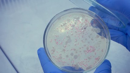 Sticker - Open a petri dish to see bacteria. Close-up scientist in blue gloves opens a petri dish with colonies of bacteria.