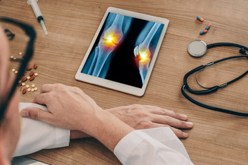 Wall Mural - Doctor watching a digital tablet with x-ray of legs with pain in the knees