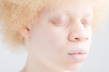 Portrait Of Albino Girl With Close Eyes