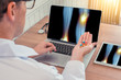 © steph photographies - Doctor holding pills with x-ray of legs with pain on the knee and ankle on the laptop and digital tablet. Digital tablet on the wooden desk