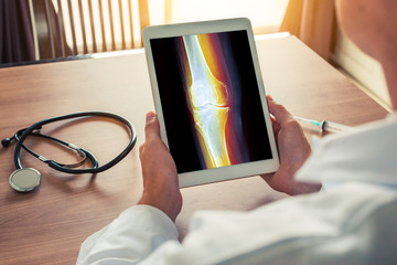 Wall Mural - Doctor holding a digital tablet with x-ray of knee. Pain on the leg. Stethoscope and syringe on the desk