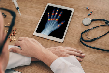 Doctor watching a digital tablet with x-ray of a left hand with pains on the joints of the fingers. Osteoarthritis concept